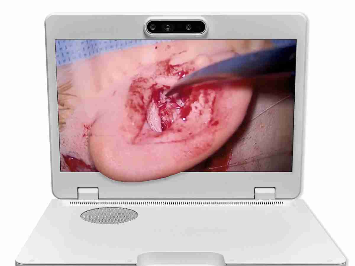 达擎之＂Heads-up 3D显微手术显示系统＂，，整合4K裸眼3D显示及眼球追踪系统，，，，具备快速追踪人眼移动位置功能，，，，减轻医师长时间维持固定姿势的负担，，让医师能有更宽广清晰的3D立体视野及更舒适的姿势来执行手术。。